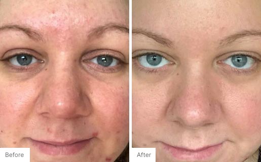 6 - Before and After Real Results of Age IQ Day Cream on a woman's face