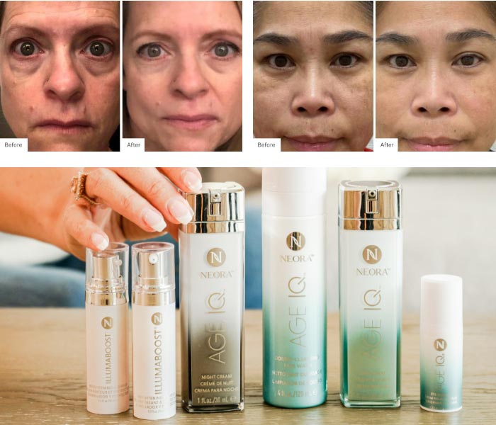 Before and After photographs of two women showing their Real Results from use of Neora skincare products. Underneath the Real Results photos is a photograph of several Neora skincare products including IllumaBoost Vitamin C Serum, Age IQ Night Cream, Double-Cleansing Face Wash, Day Cream and Eye Serum.